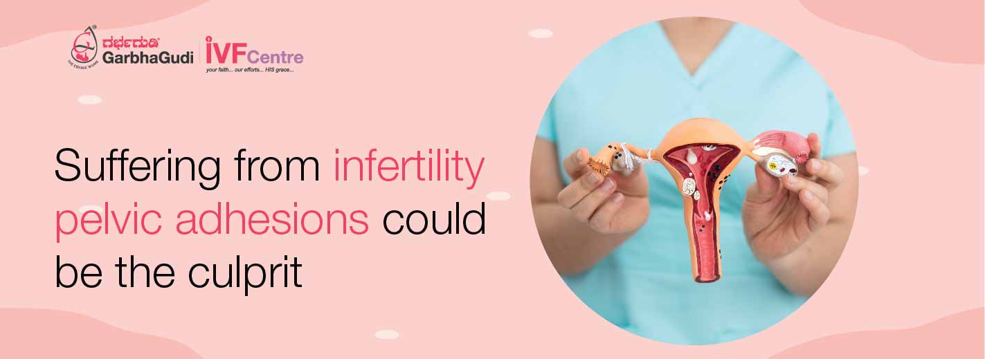 Are you suffering from Infertility? Pelvic Adhesions could be the Culprit!