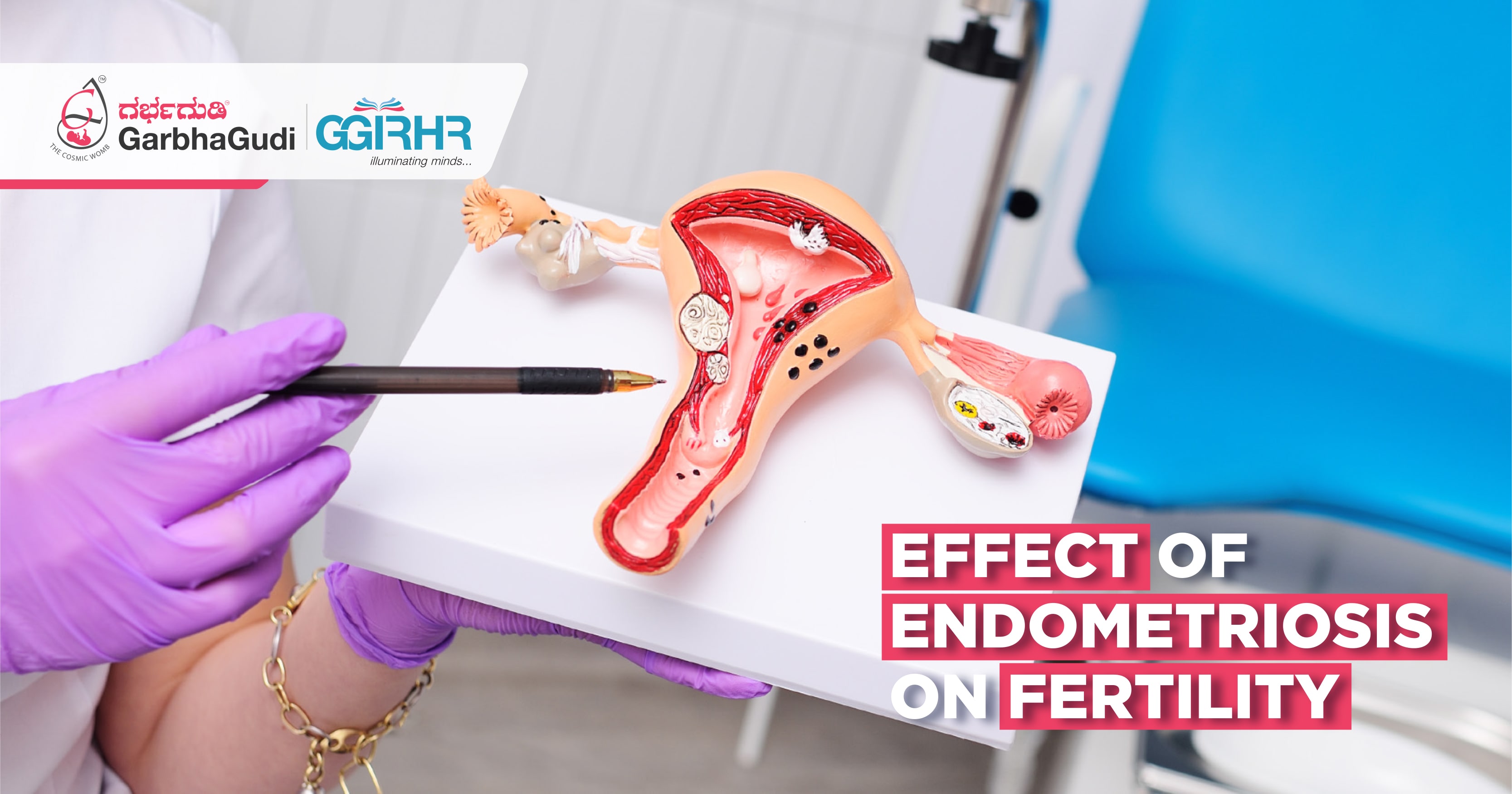 Effect of Endometriosis on Fertility
