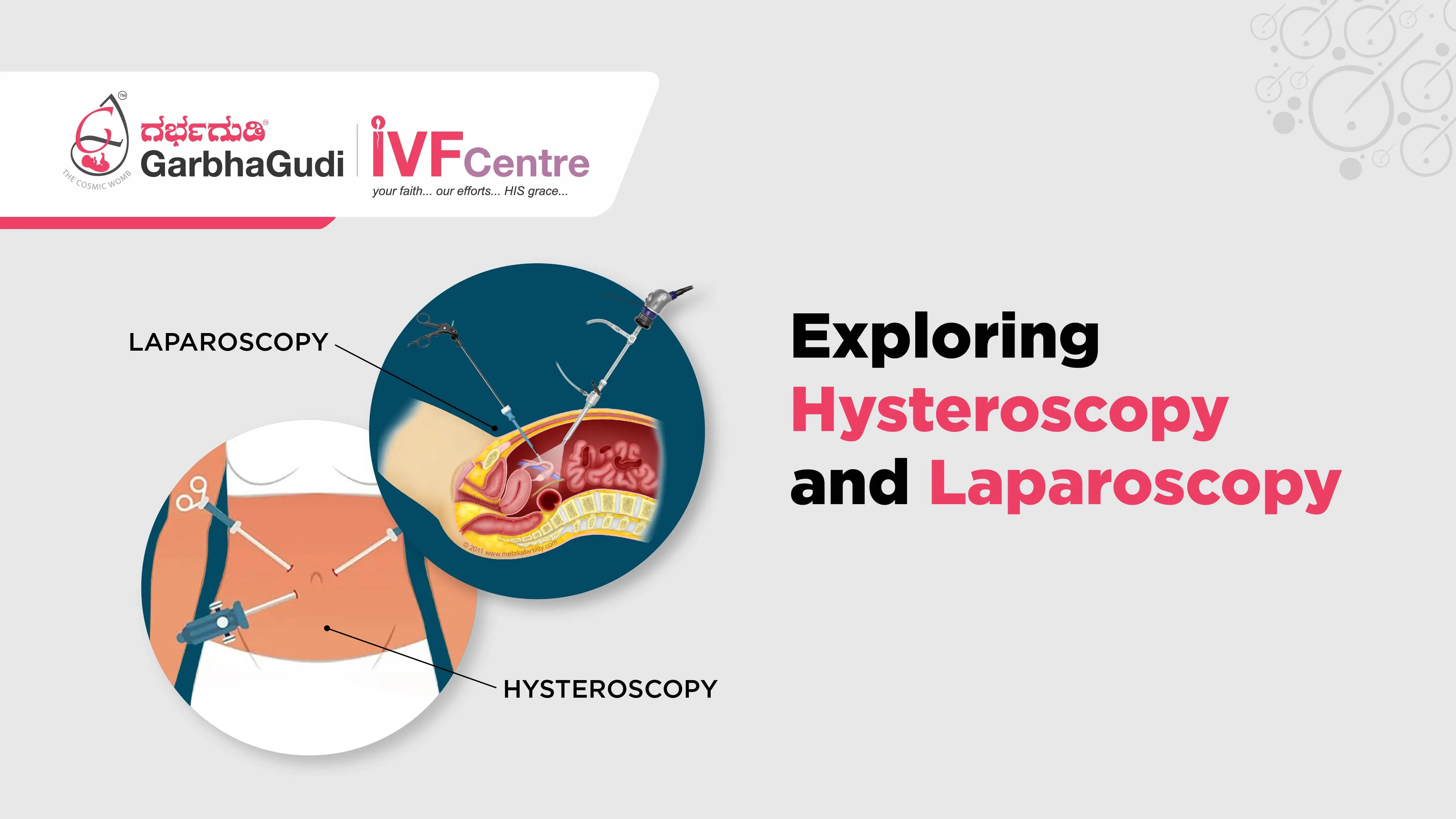 Exploring Hysteroscopy and Laparoscopy