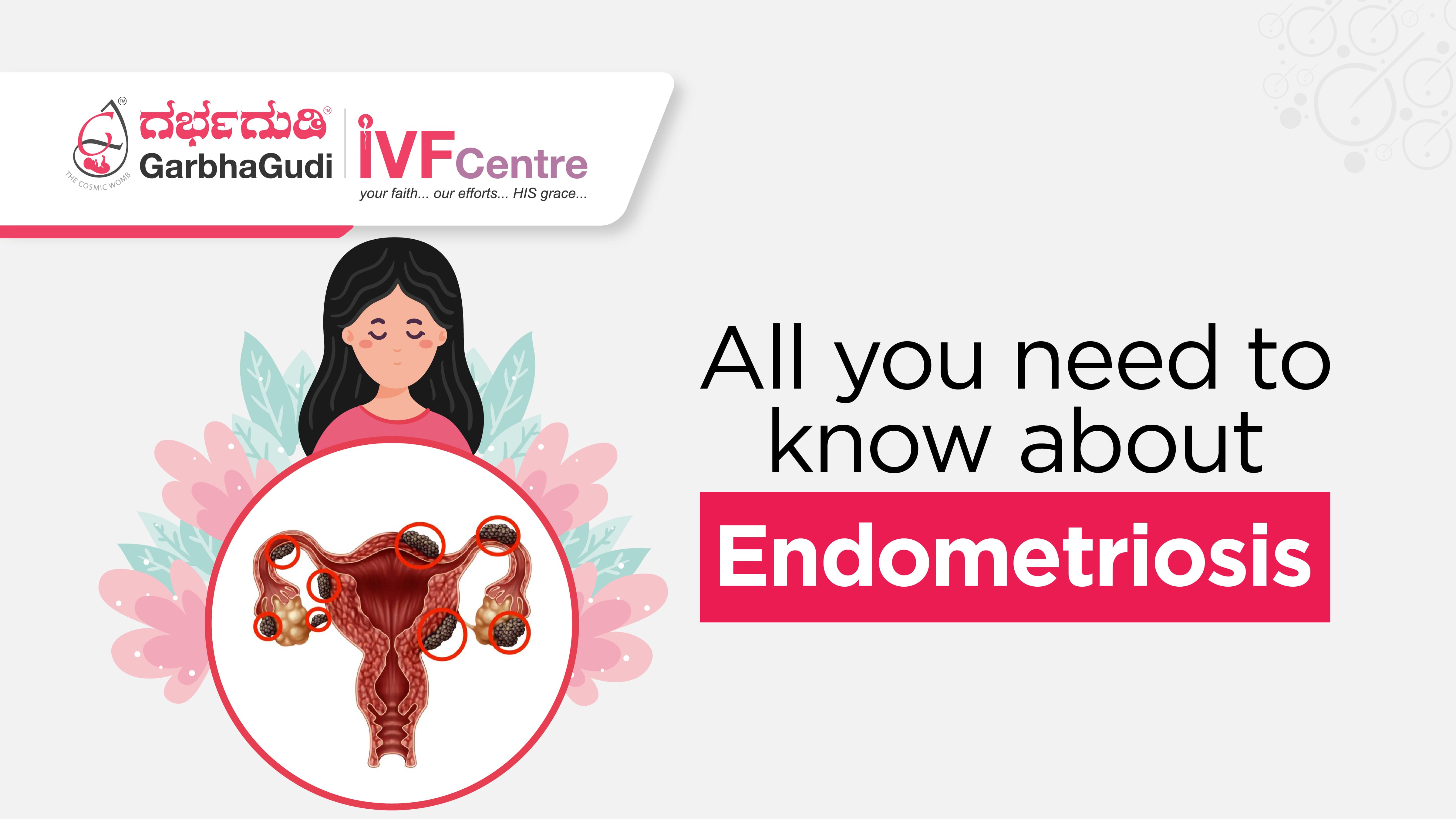 Endometriosis and Infertility: Everything You Need to Know