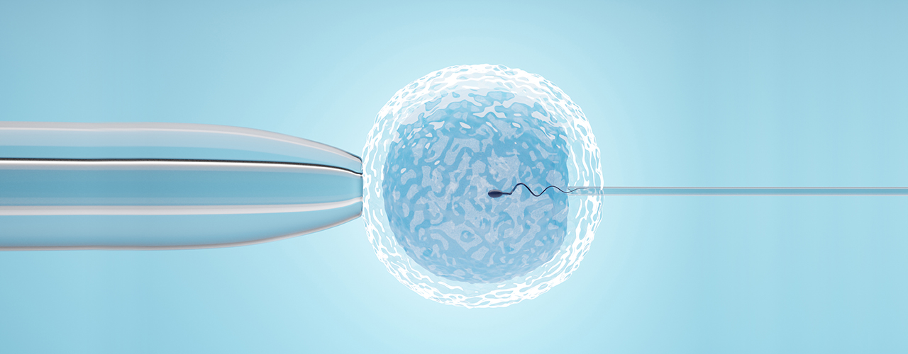 In-vitro Fertilization (IVF)