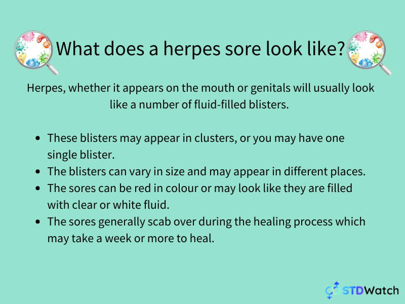 what-does-herpes-look-like-infographic