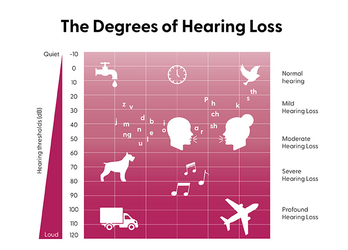 Understanding Different Types of Hearing Loss [Infographic]