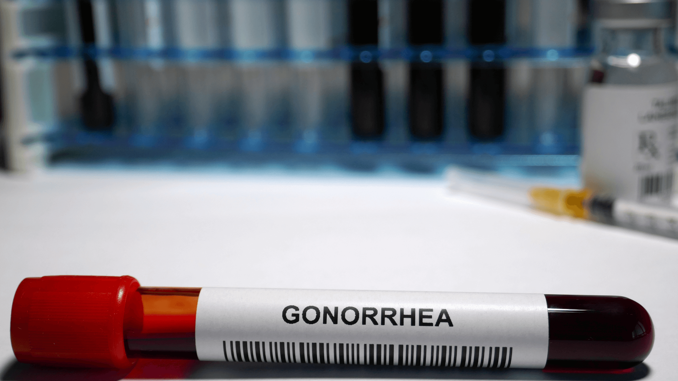 blood-gonorrhea-test
