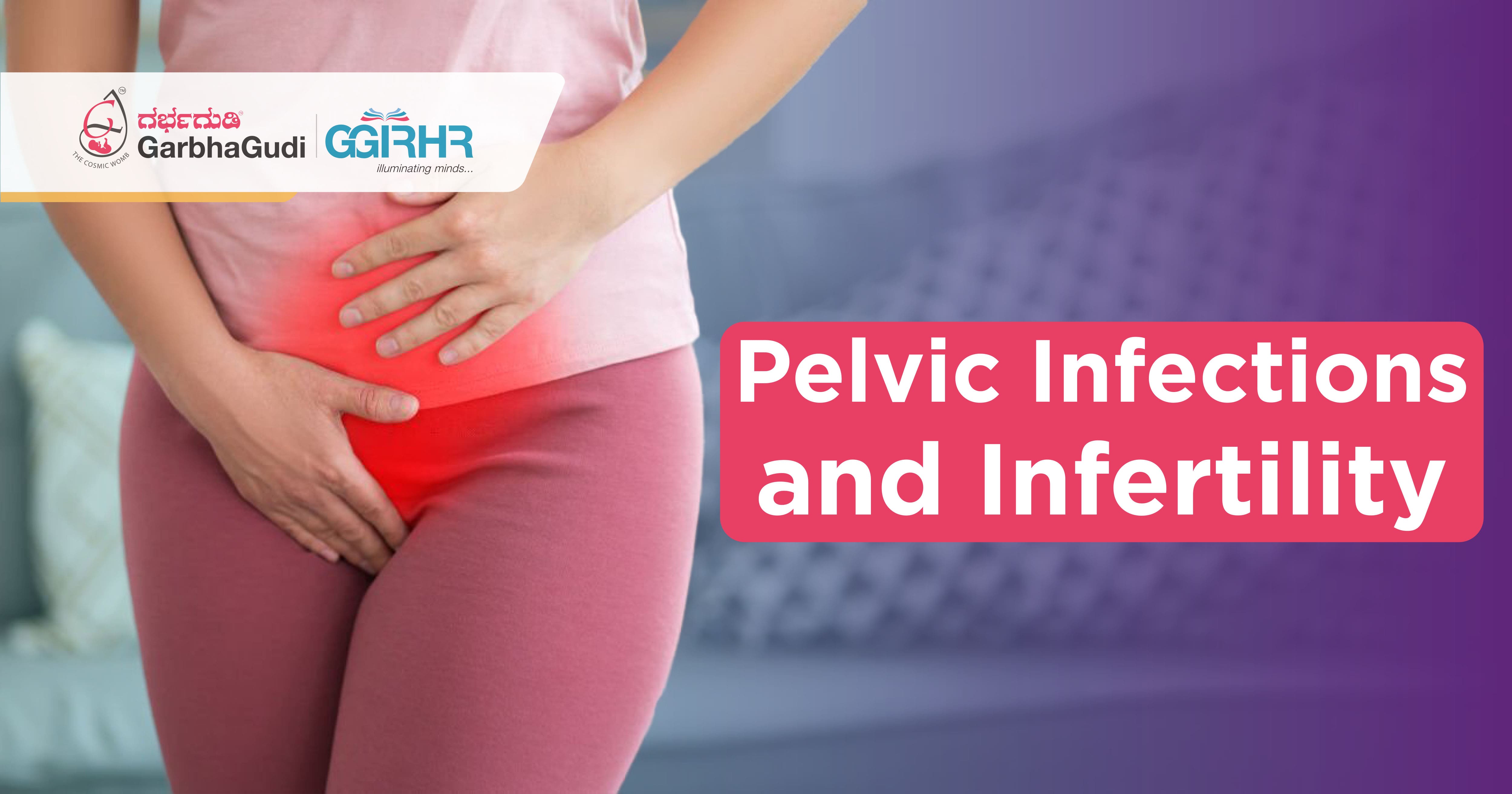 Pelvic Infections and Infertility
