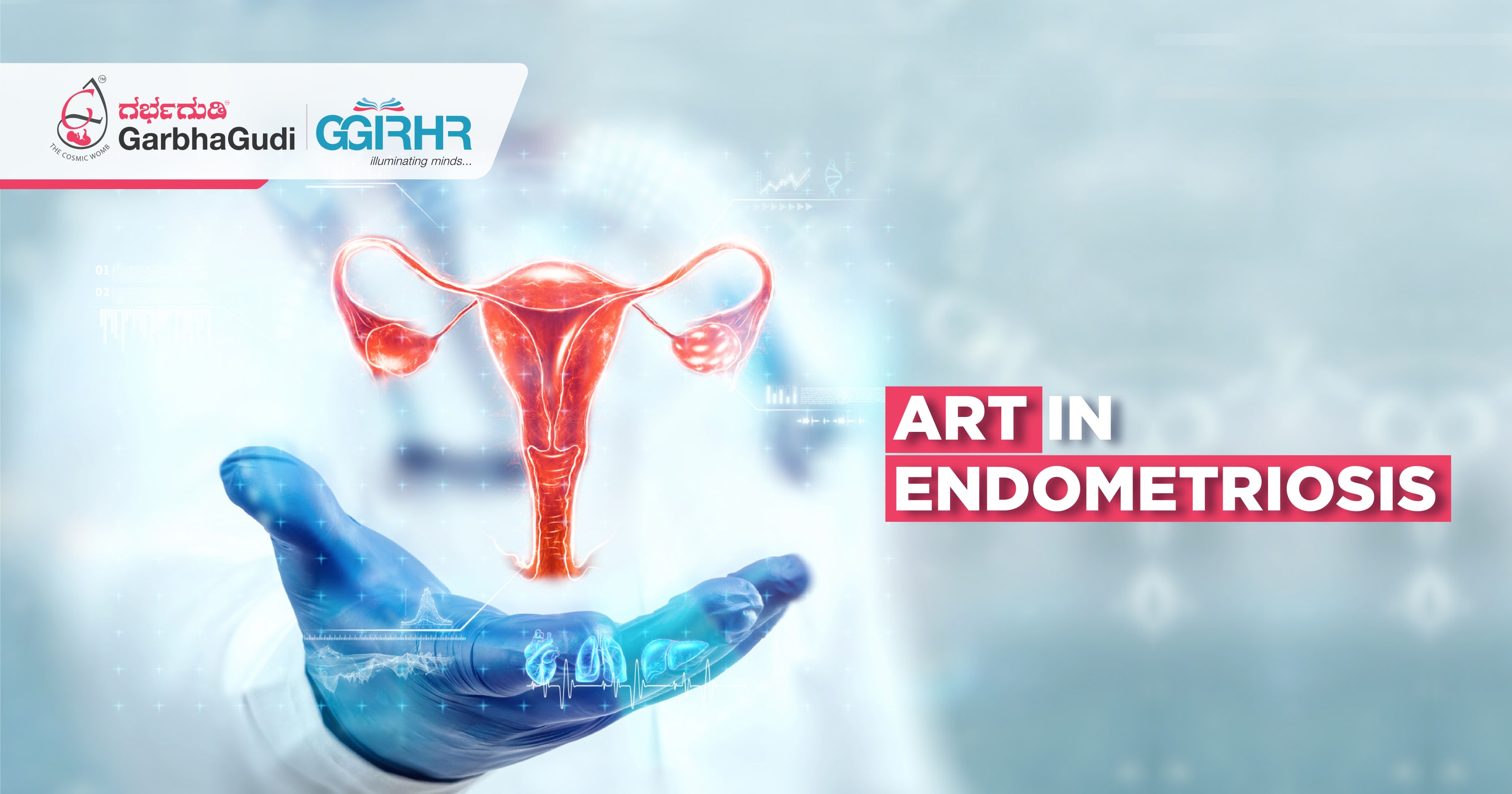 ART in Endometriosis
