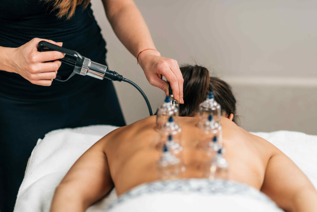 Woman receiving cupping treatment at spa