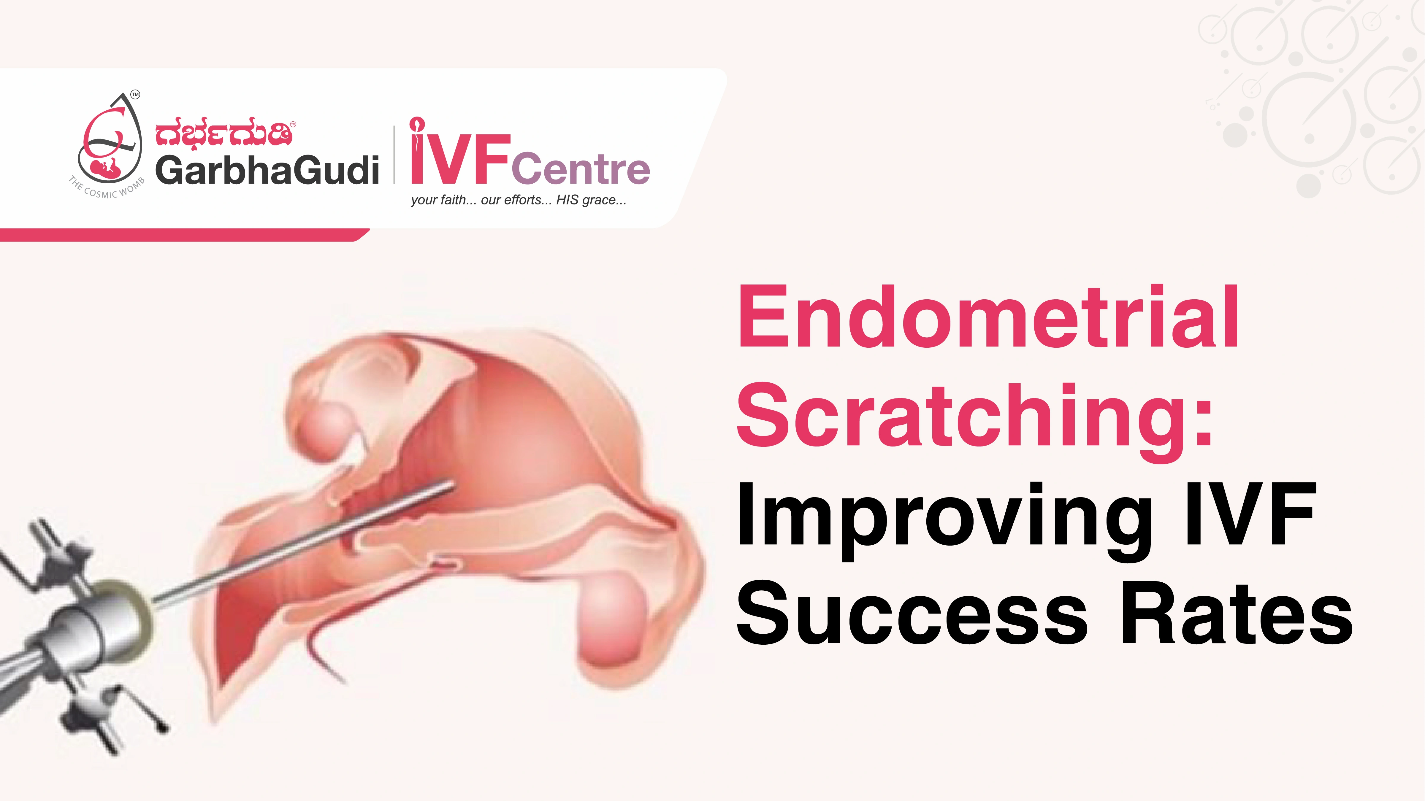 Endometrial Scratching: Improving IVF Success Rates
