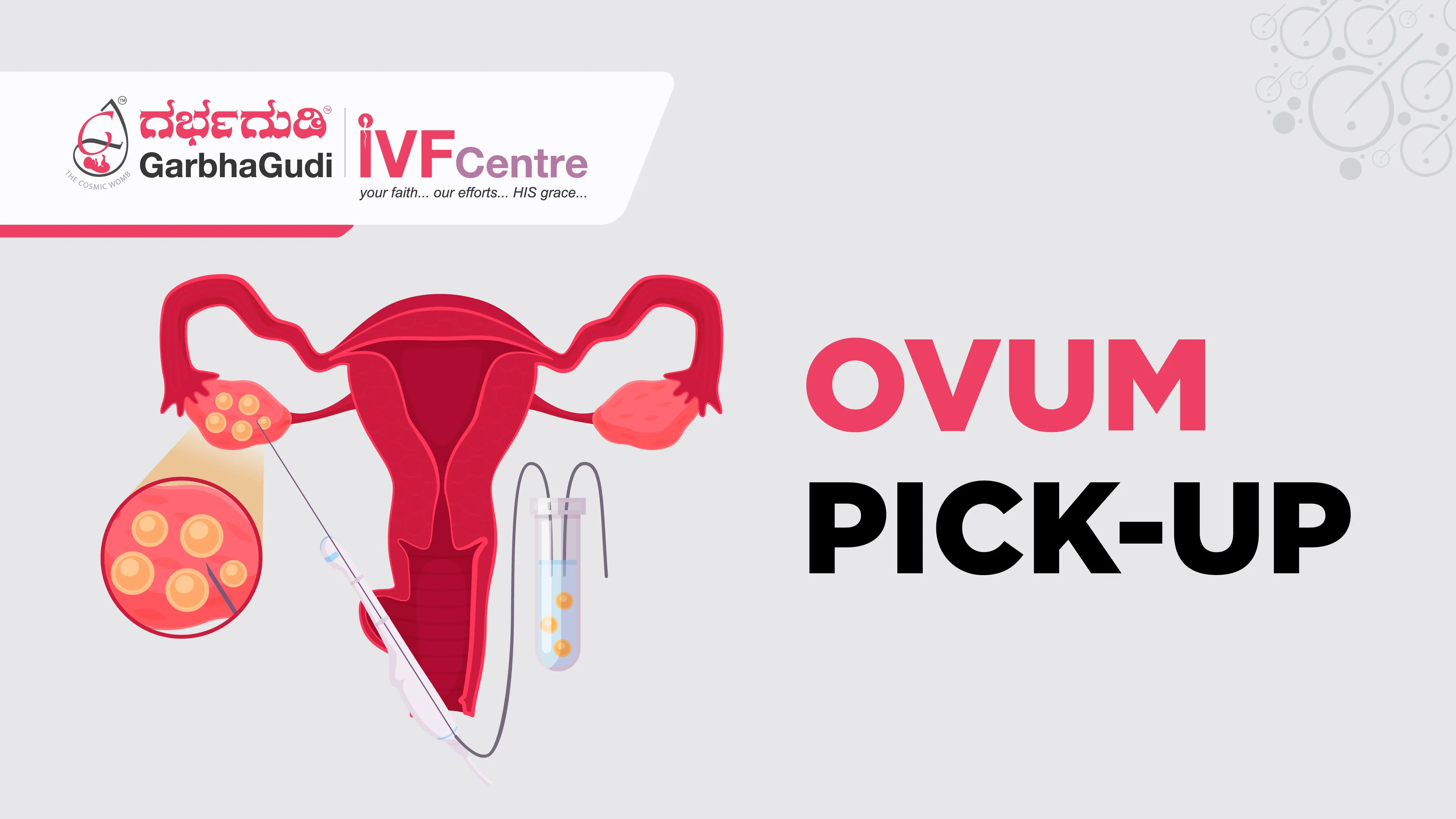 OVUM PICK-UP