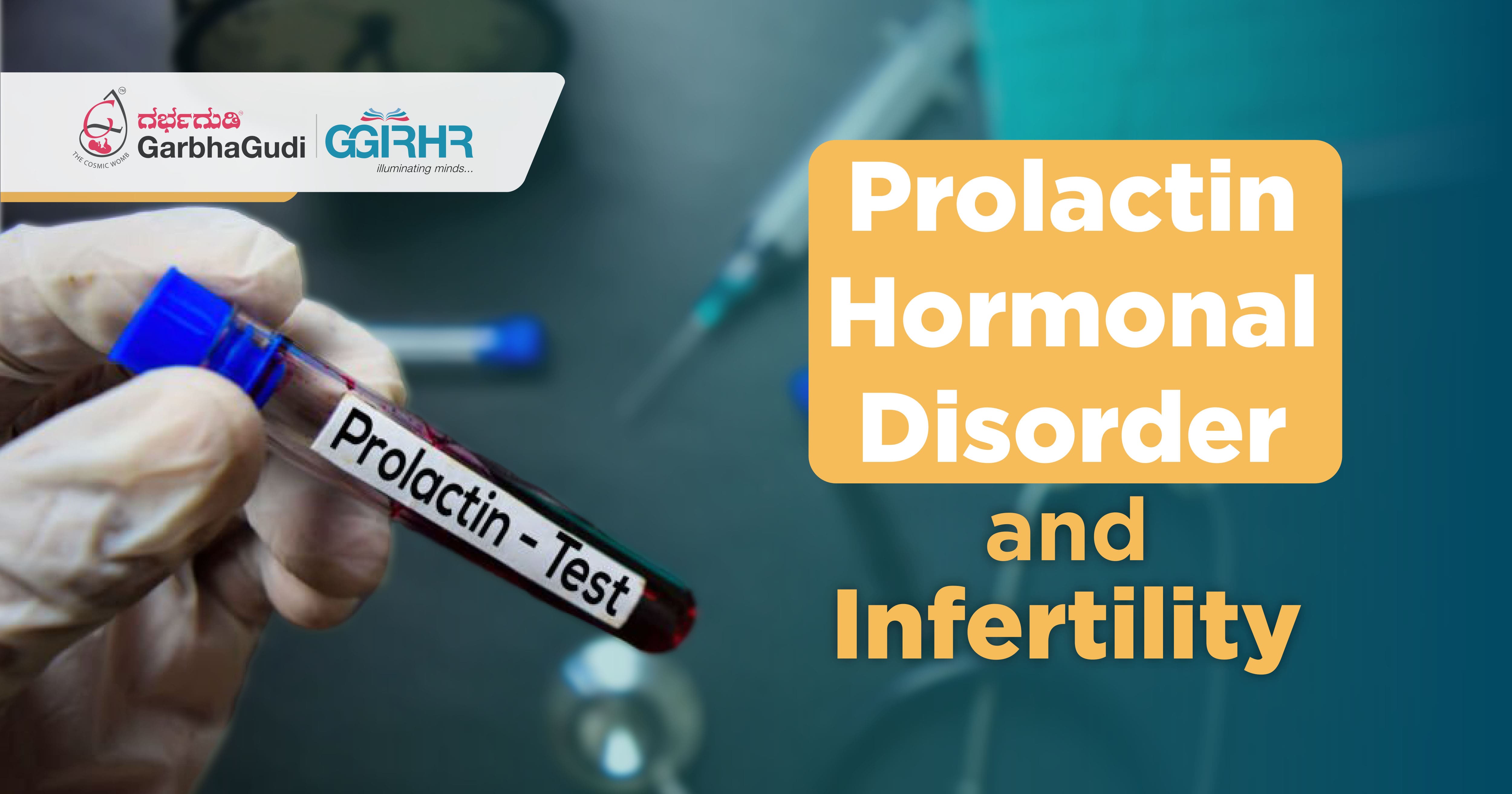 Prolactin Hormonal Disorders and Infertility