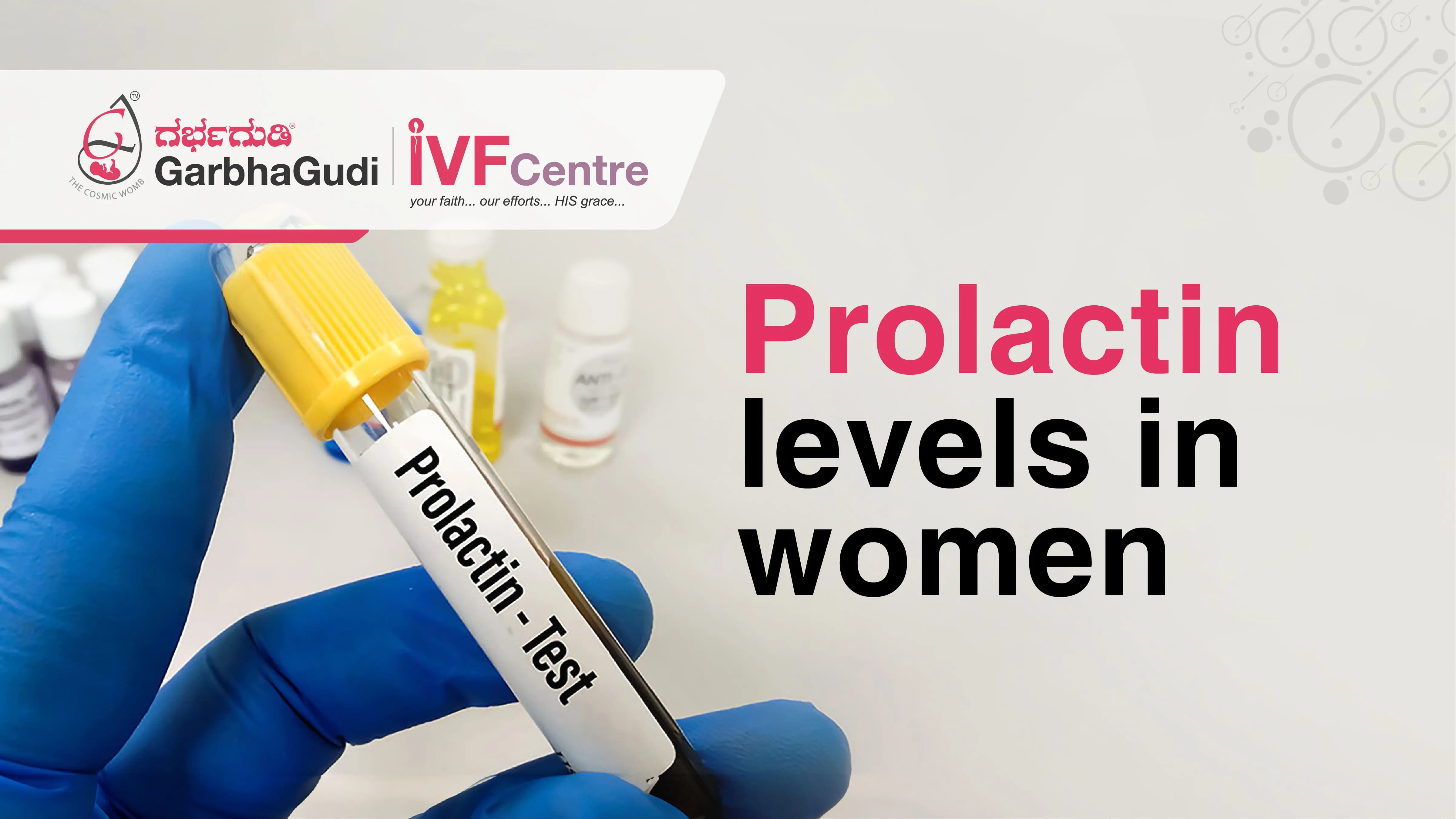 Prolactin levels in women