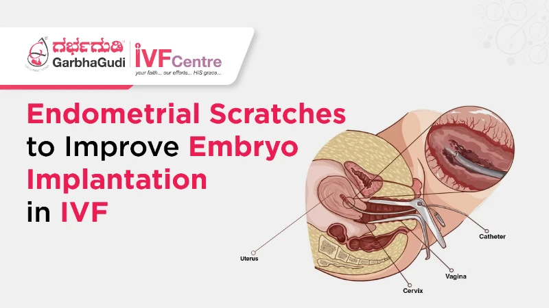 What Are Endometrial Scratches, and Do They Improve Implantation?