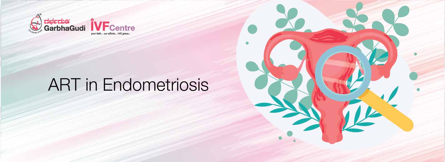 ART in Endometriosis