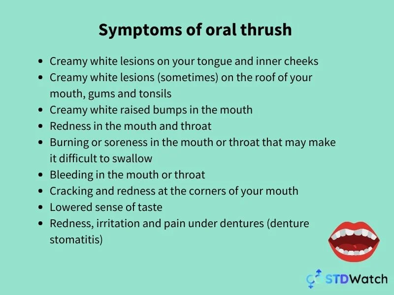 symptoms-of-oral-thrush