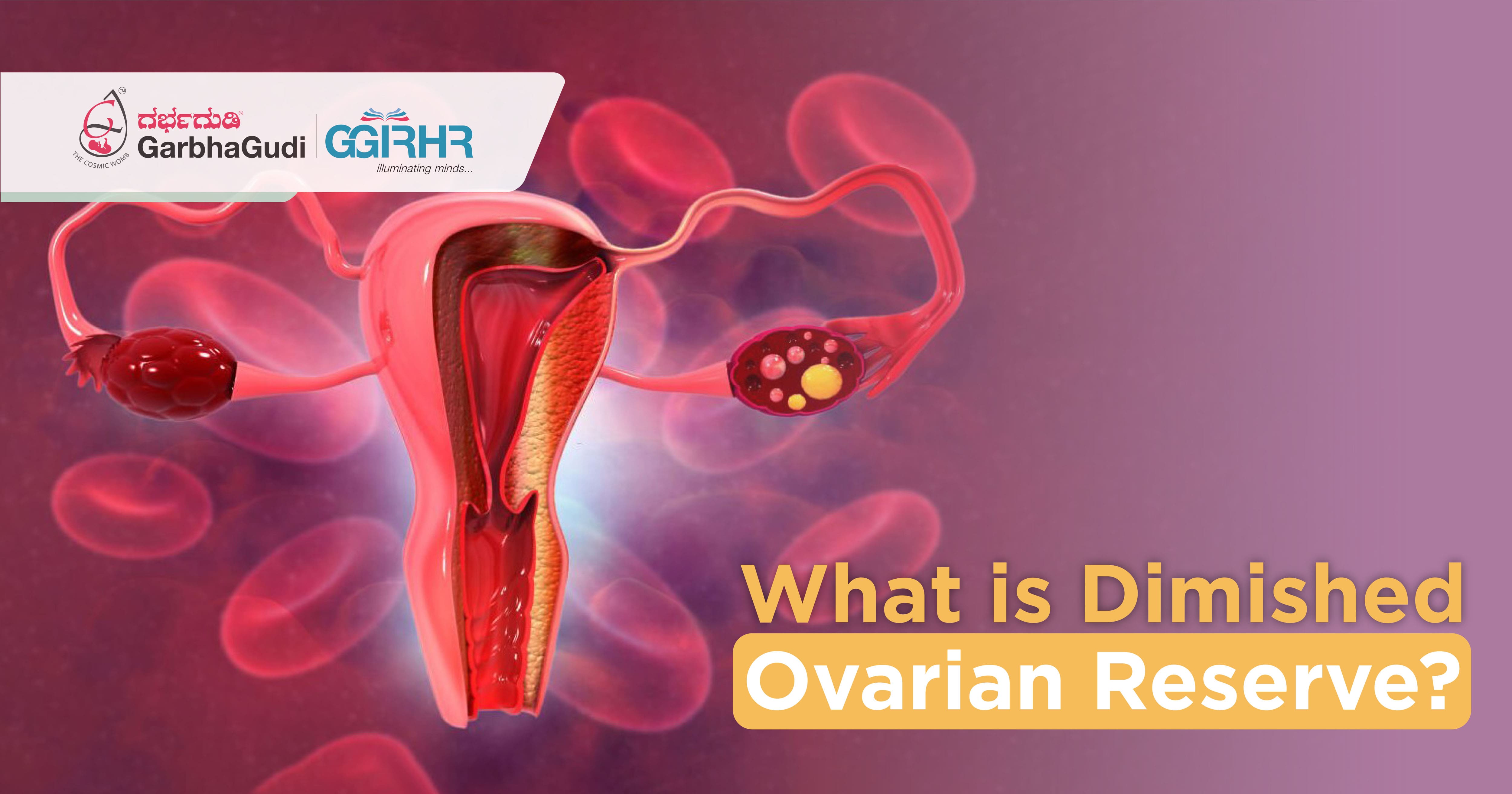 What Is Diminished Ovarian Reserve?