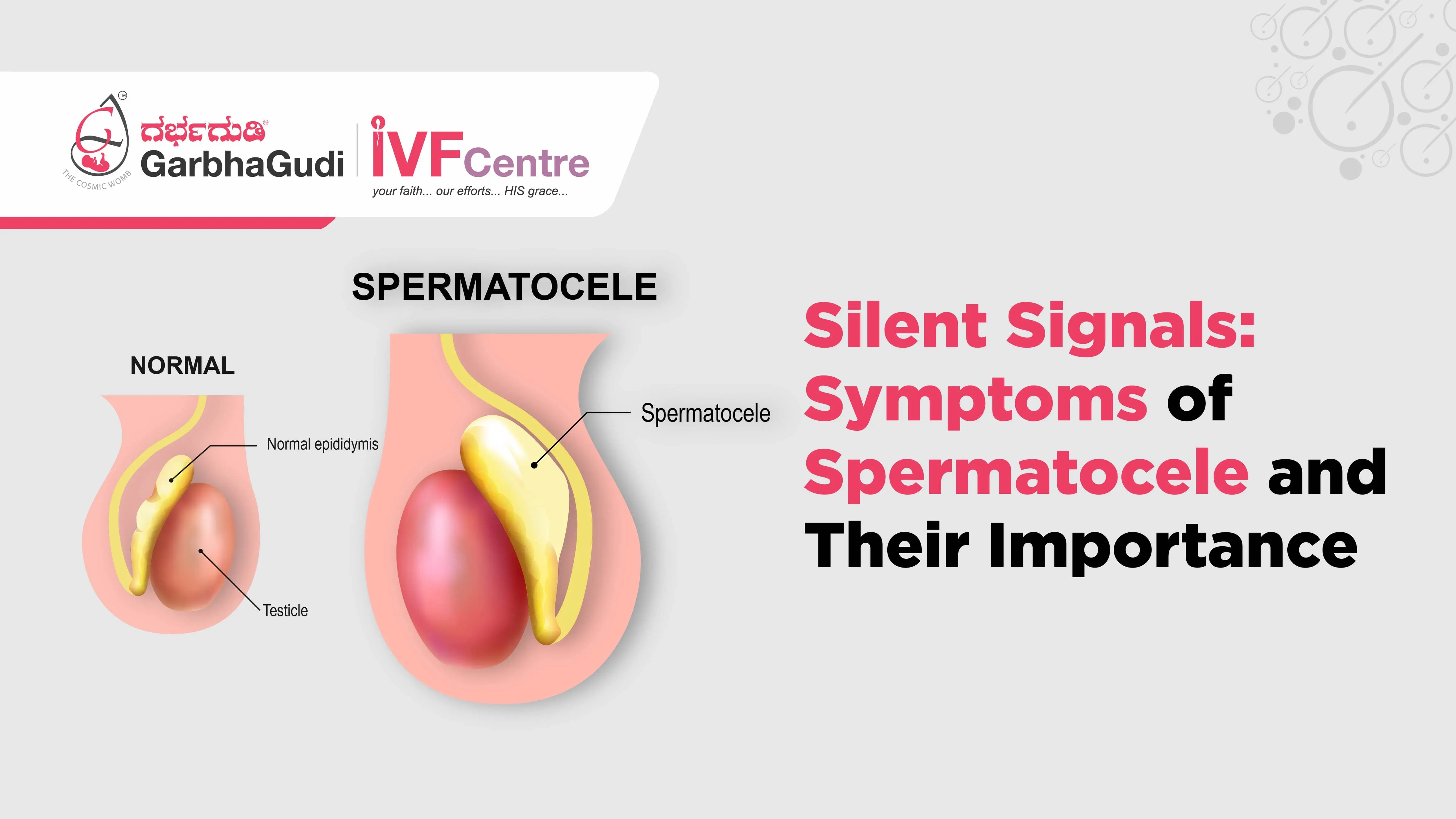 Silent Signals: Symptoms of Spermatocele and Their Importance