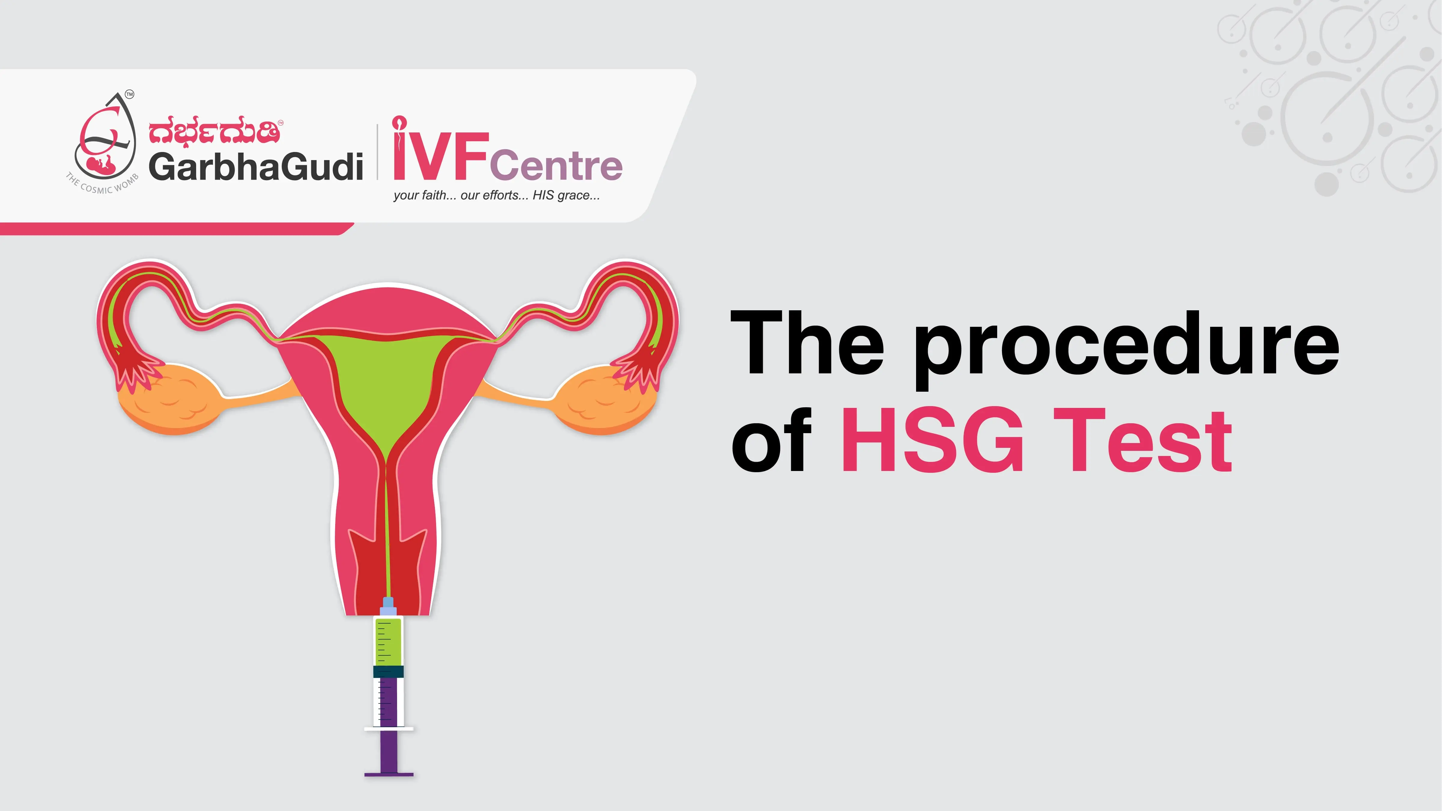 The procedure of the Hsg test 