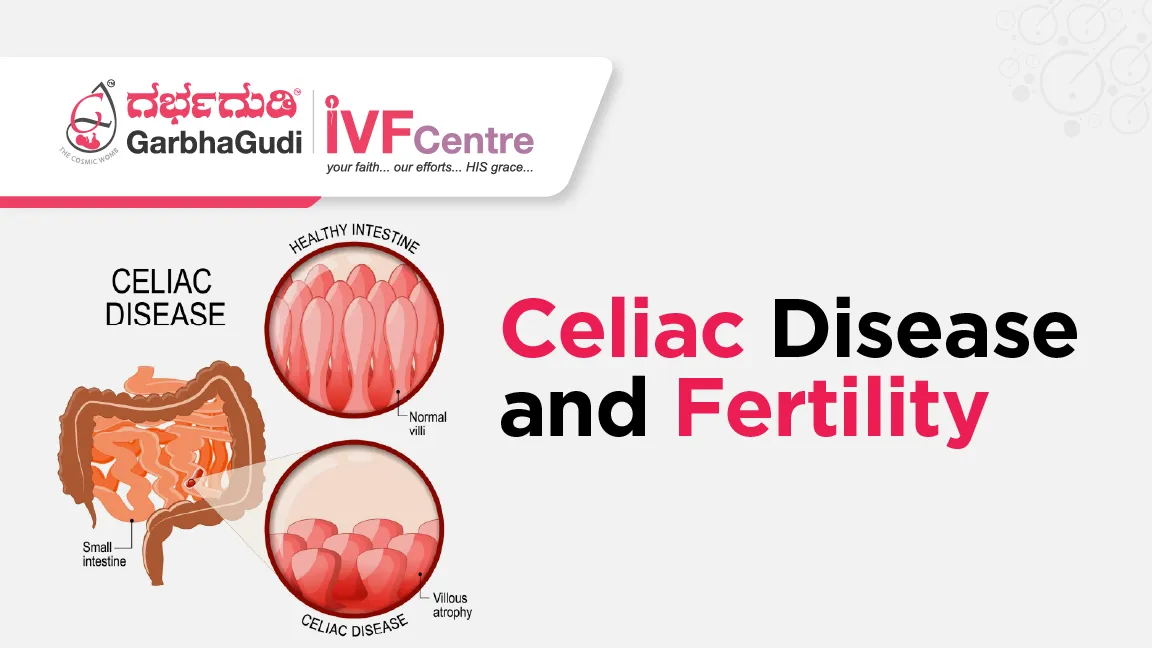  The Impact of Celiac Disease on Fertility: What You Should Know Before Trying IVF