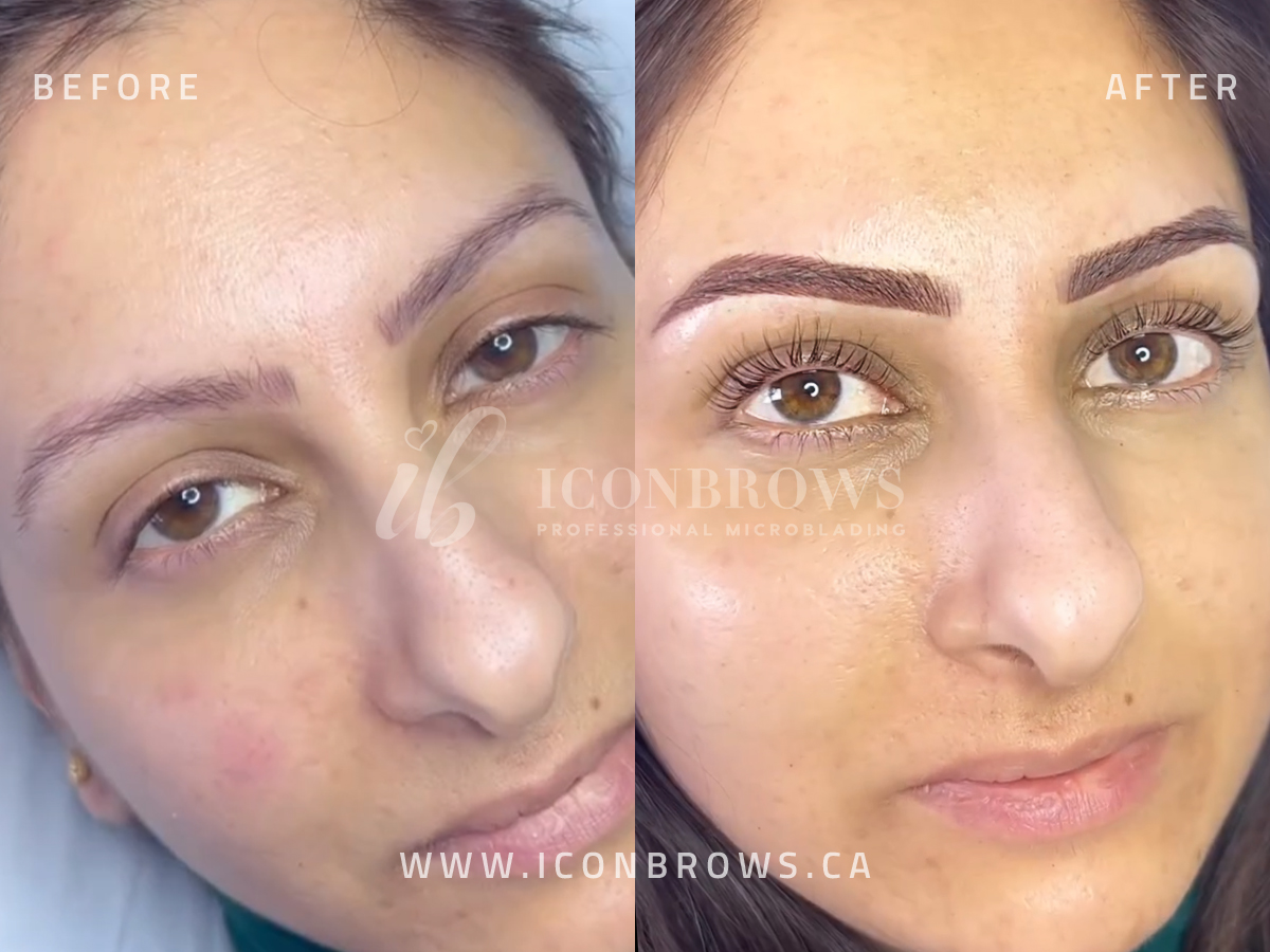 eyebrow-color-redness-correction-cover-up-by-iconbrows-professional-microblading-in-toronto-ontario-m8v-0c8-canada.jpg