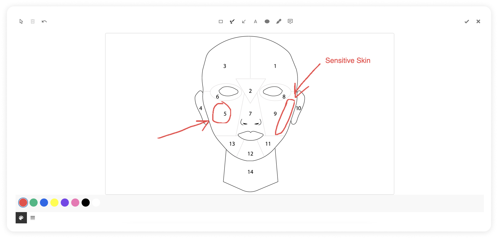 Draw annotate on soap notes