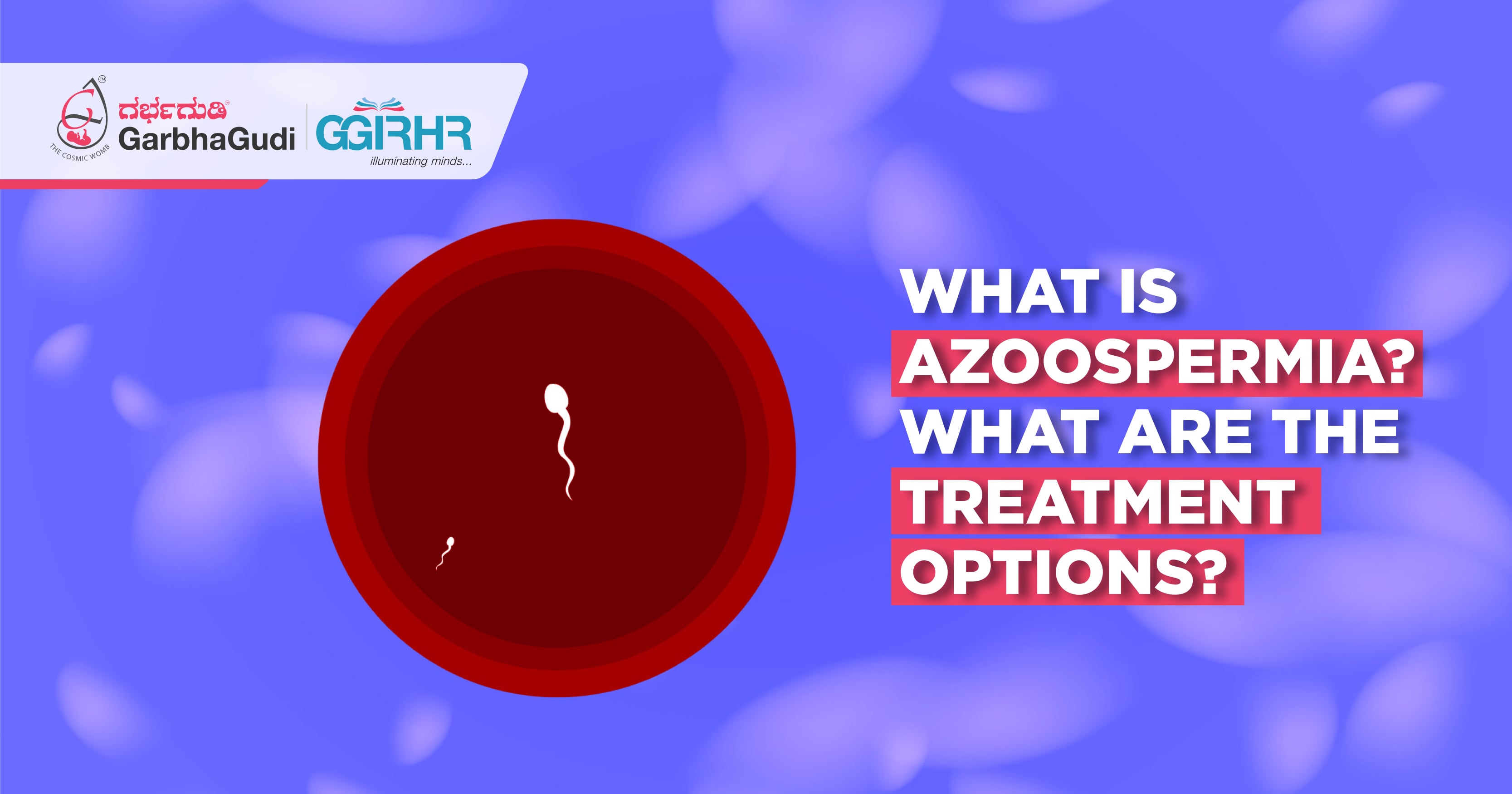 What Is Azoospermia? What Are the Treatment Options?