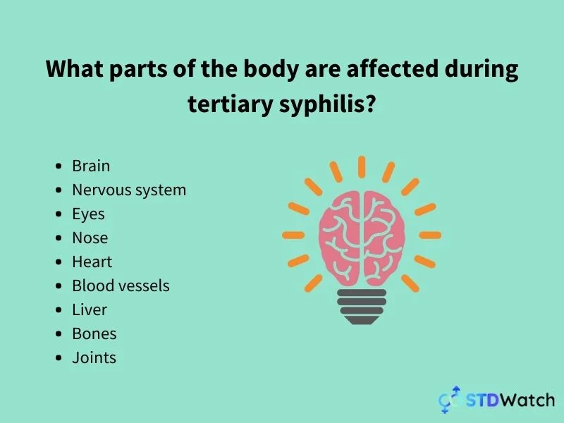 what-body-parts-are-affected-by-tertiary-syphilis