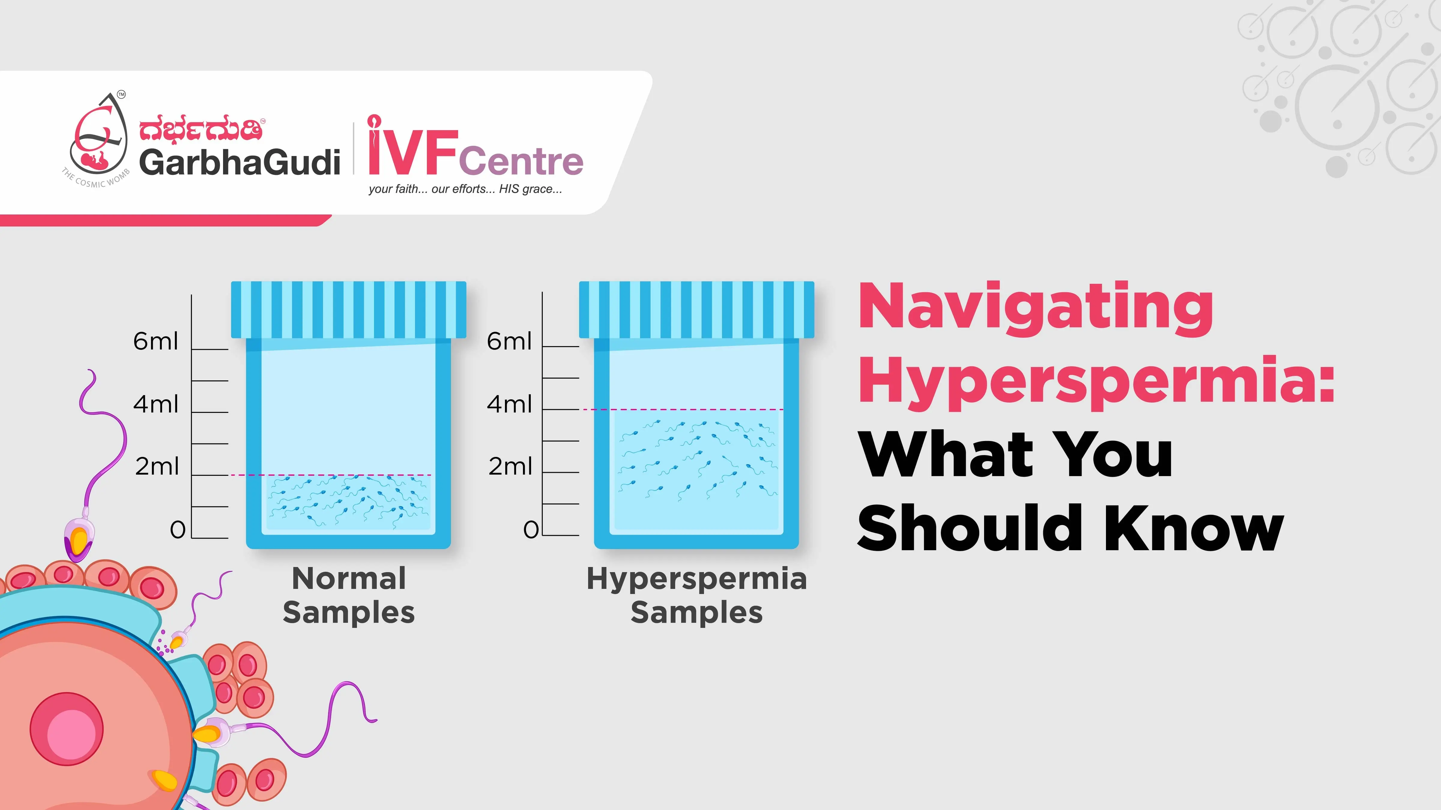 Navigating Hyperspermia: What You Should Know