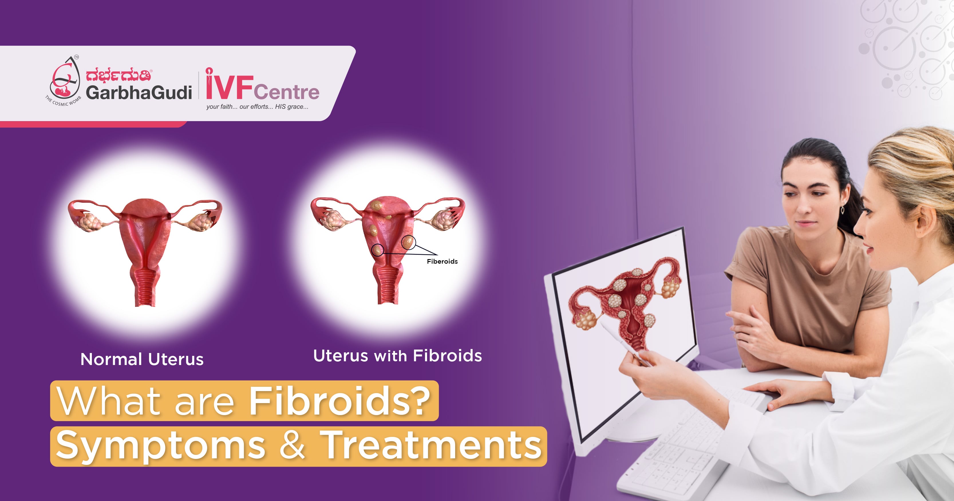 What are Fibroids? Symptoms & Treatments 