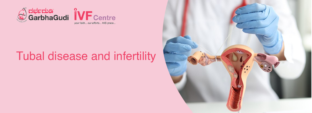 Tubal Disease and Infertility