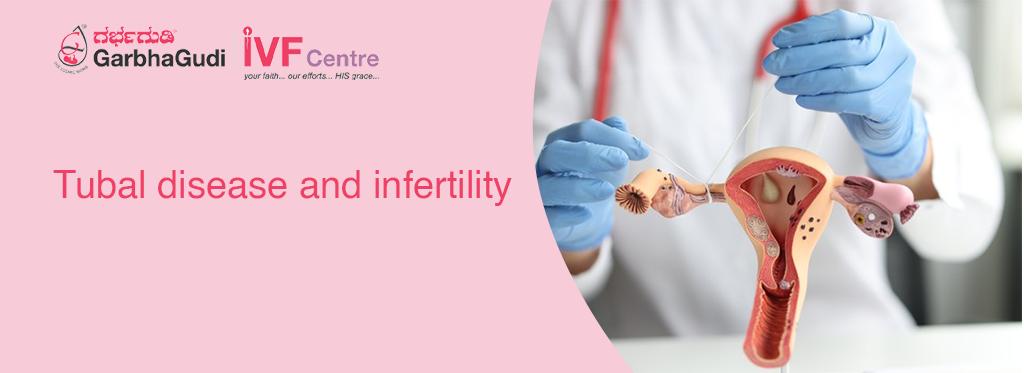 Tubal Disease And Infertility Garbhagudi Ivf Centre