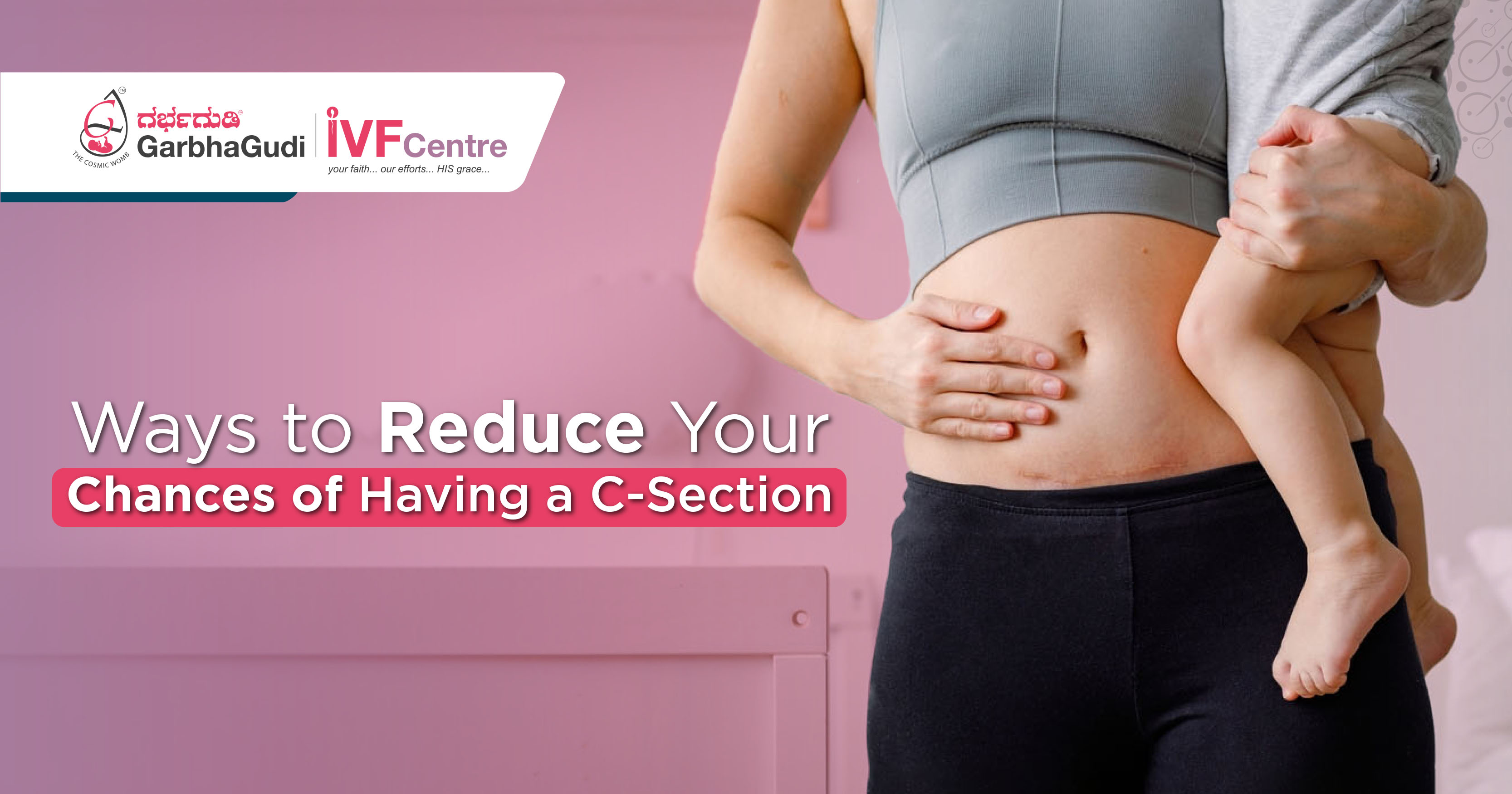 Ways to Reduce Your Chances of Having a C-Section