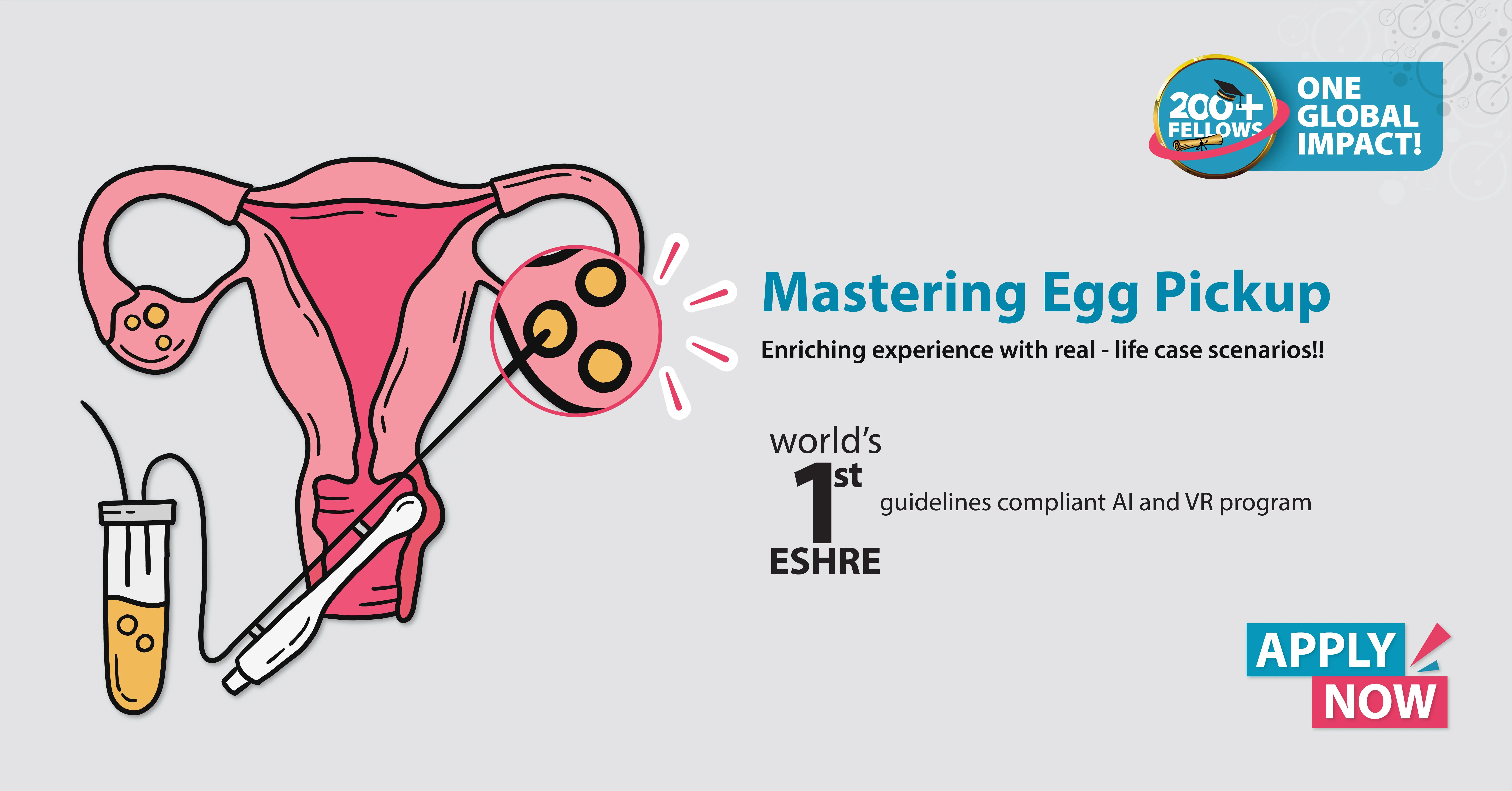 Mastering Egg Pickup [Oocyte Pickup; Ovum Pickup; OPU]