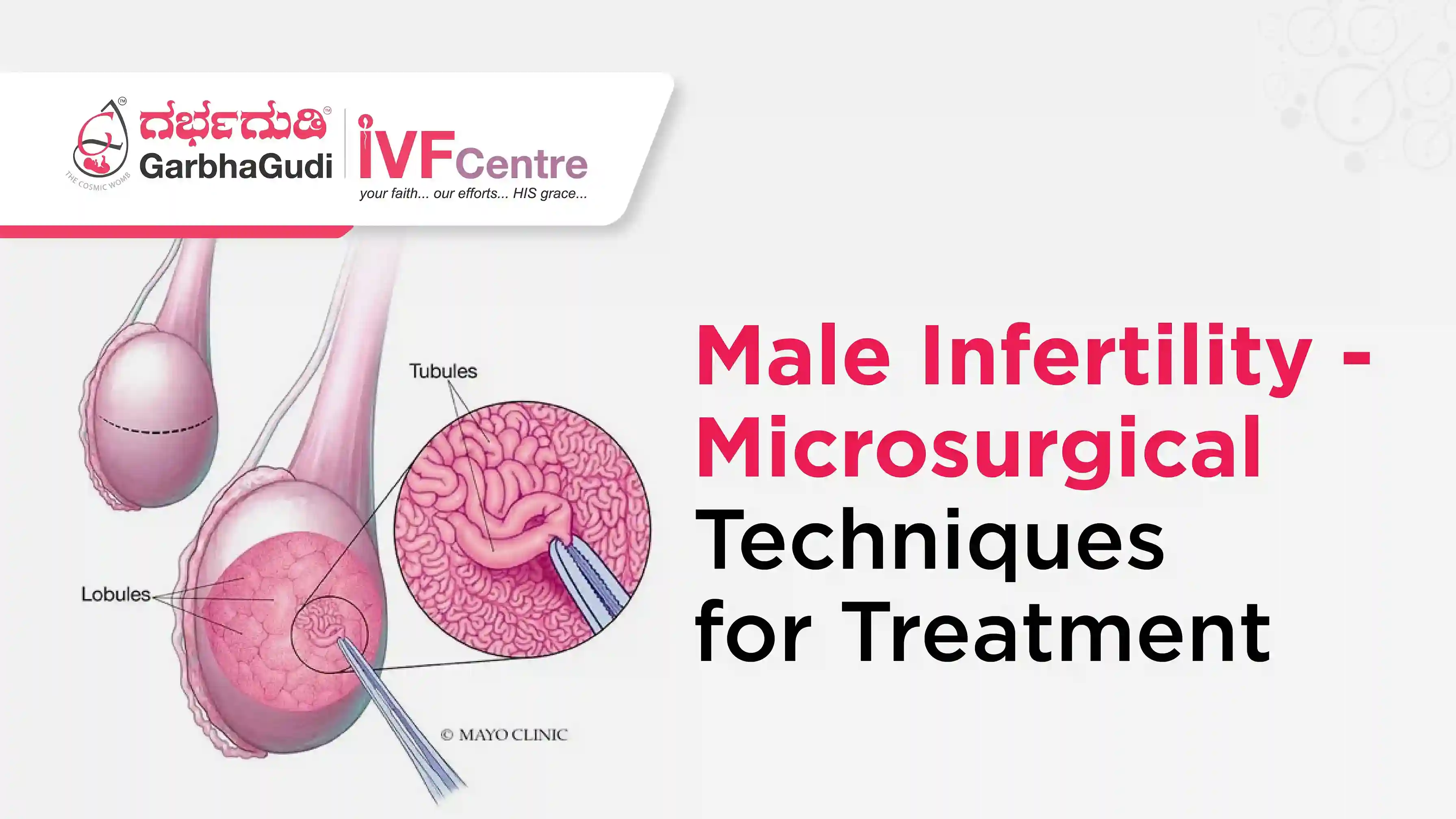 Treating Male Infertility with Microsurgical Techniques