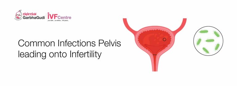 Common Infections of Pelvis Leading Onto Infertility