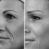 Probaskin_Collagen_Powder_28_Before_After_PDP_Split_Image