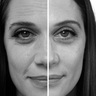 Probaskin_Collagen_Capsules_60_Before_After_PDP_Split_Image