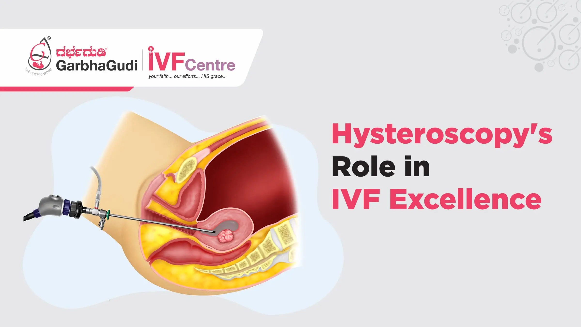 Hysteroscopy's Role in IVF Excellence