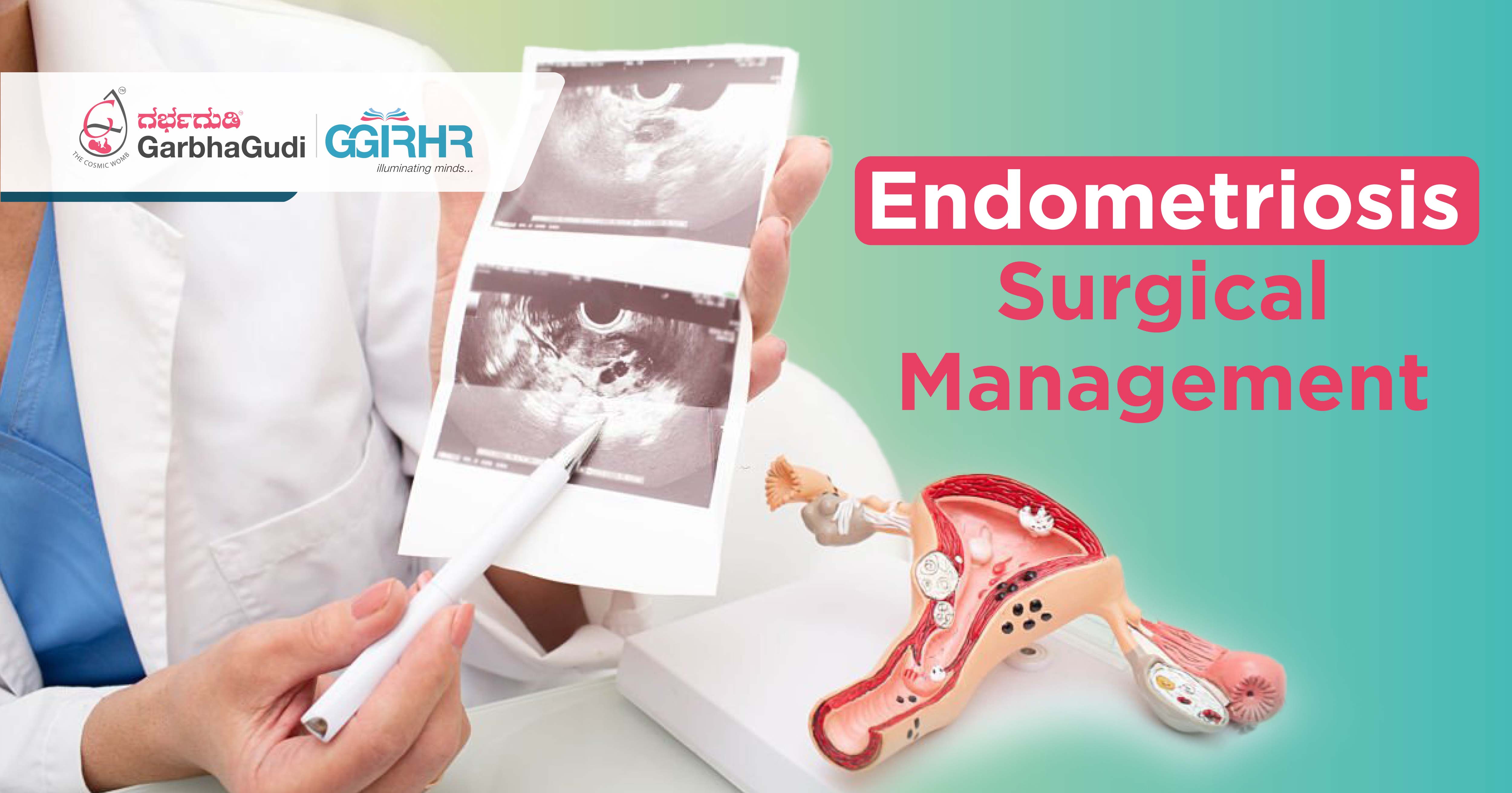 Endometriosis Surgical Management