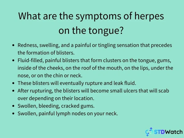 Herpes on Tongue - Causes, Symptoms & Treatment | STDWatch.com