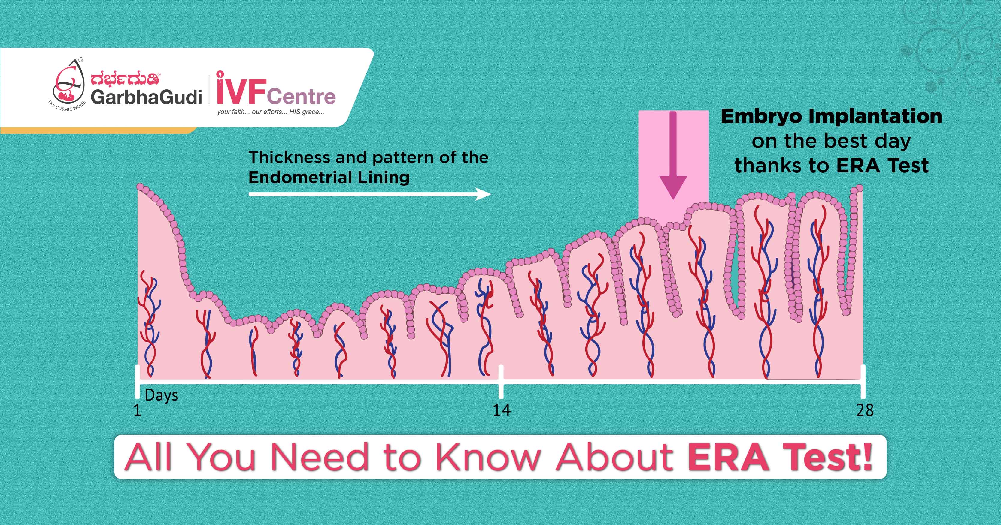 All You Need to Know About ERA Test!