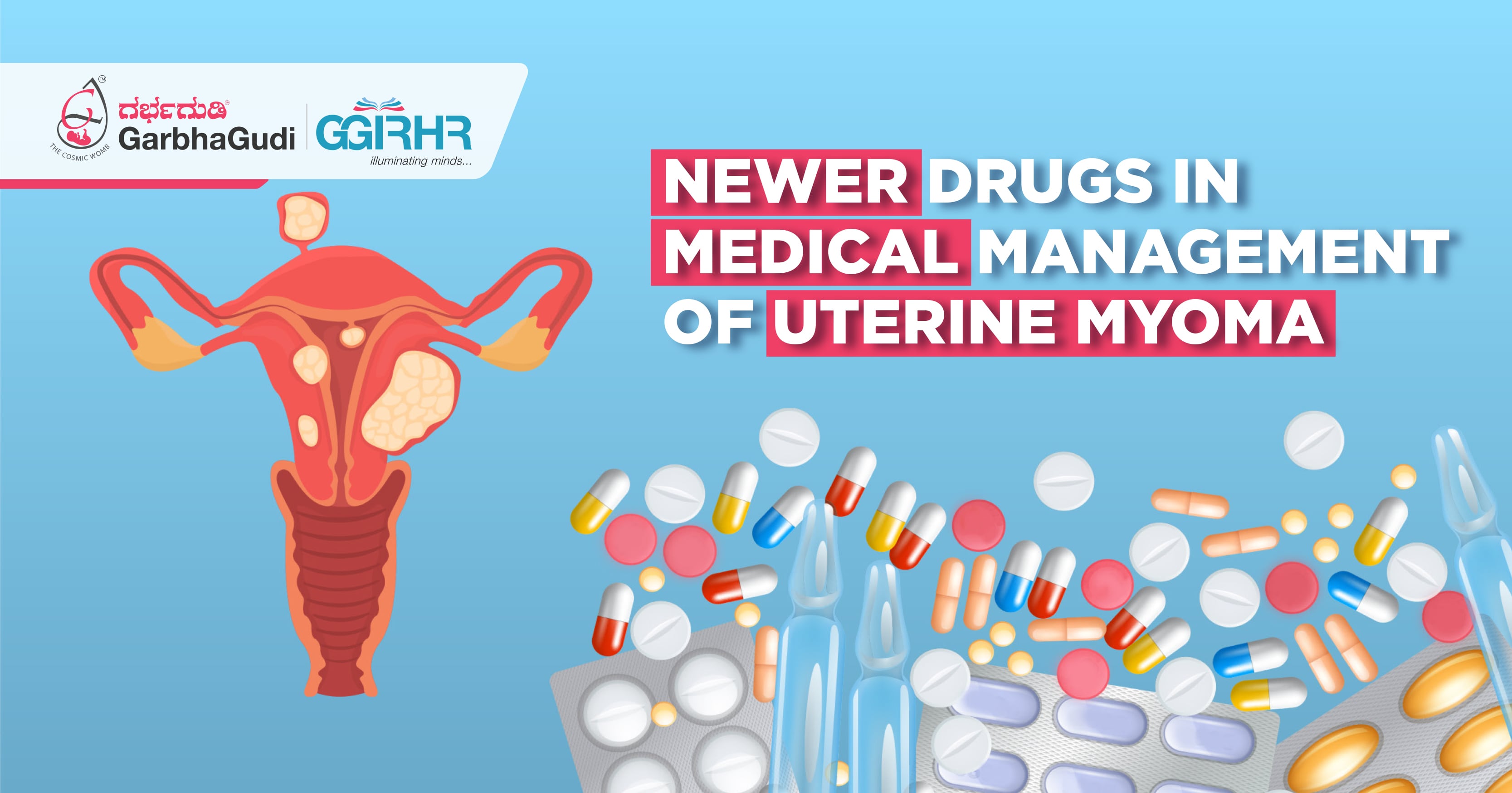 Newer Drugs in Medical Management of Uterine Myoma