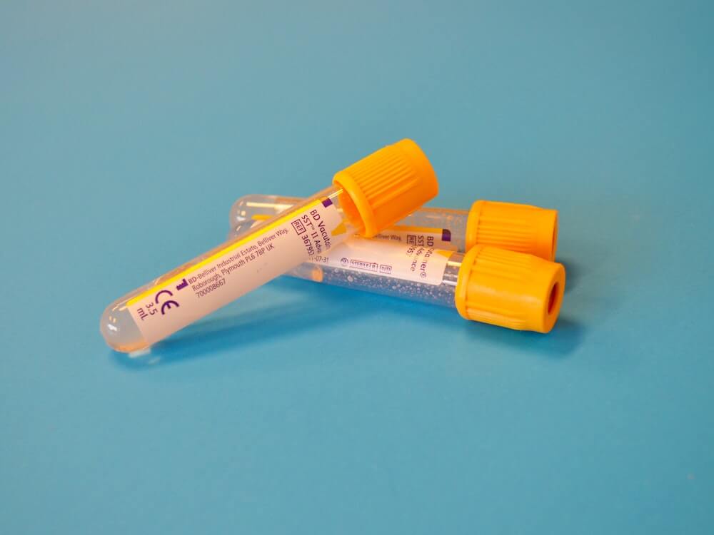at-home-chlamydia-test-tubes