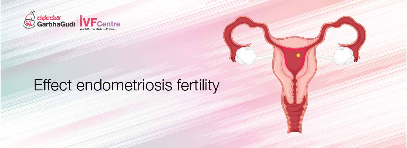 Effect of endometriosis on fertility