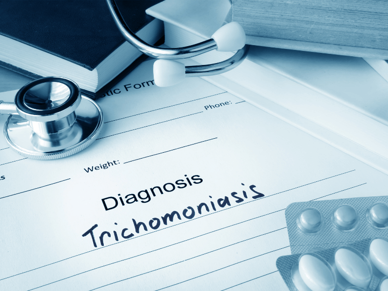 trichomoniasis-test-results