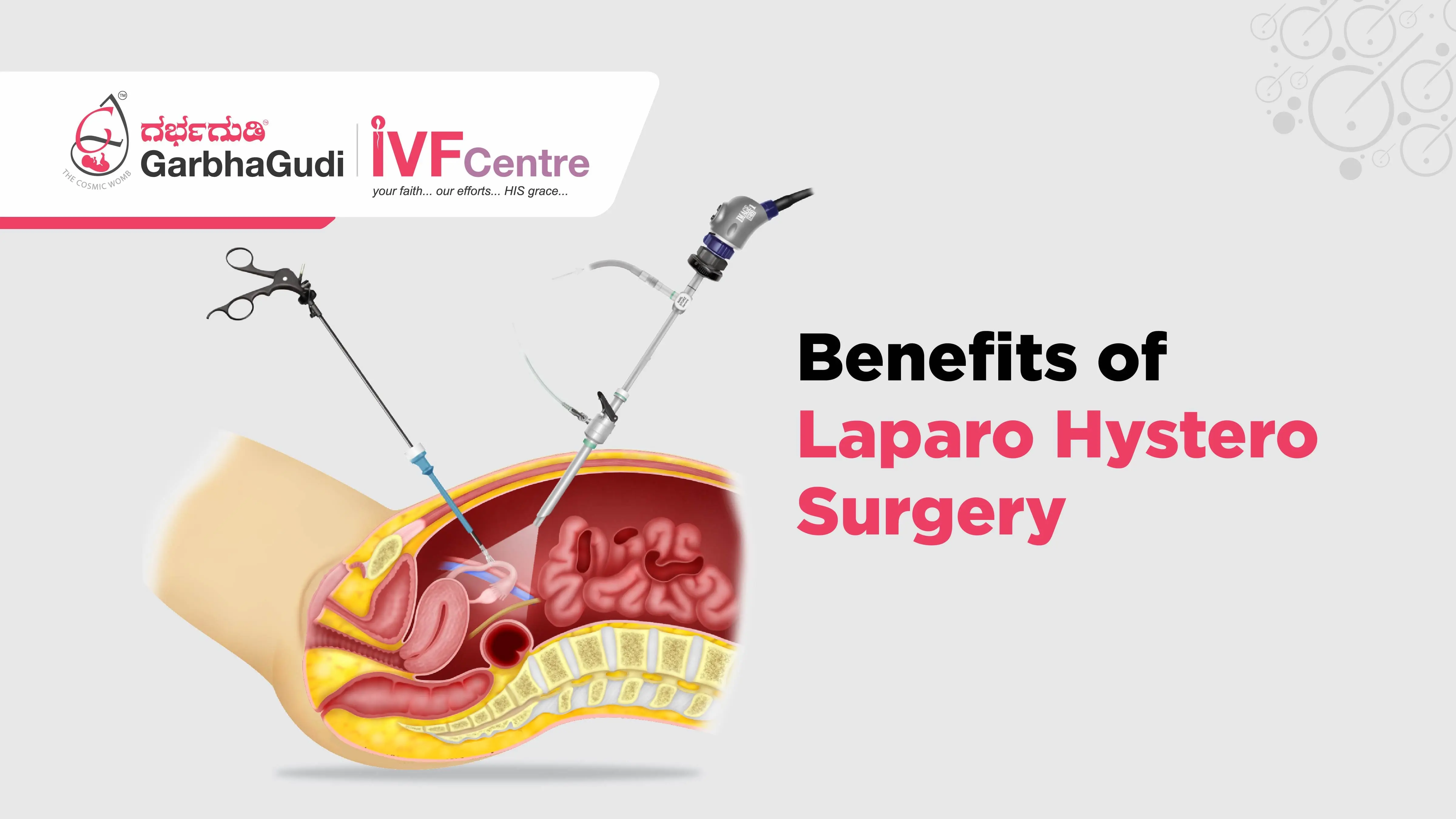 Benefits of LaparoHystero Surgery