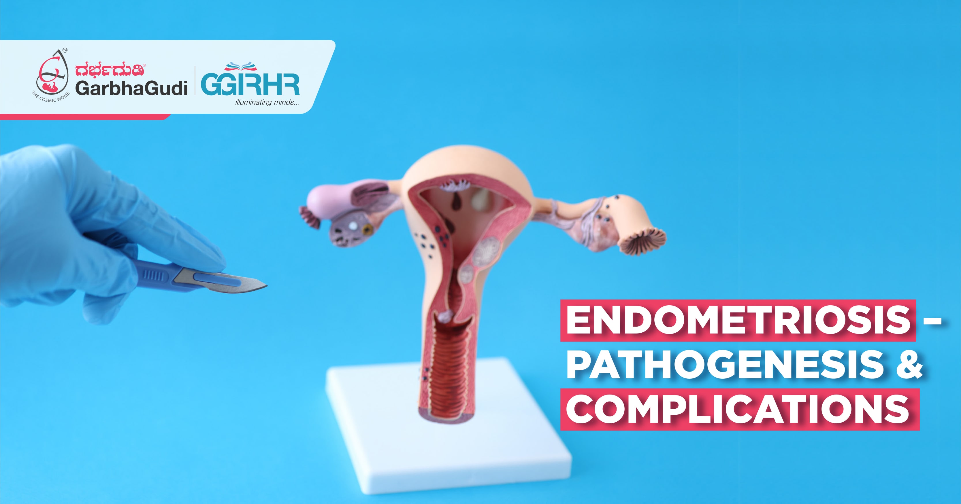 Endometriosis – Pathogenesis & Complications