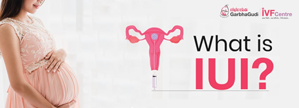 What is IUI? (Intrauterine Insemination)