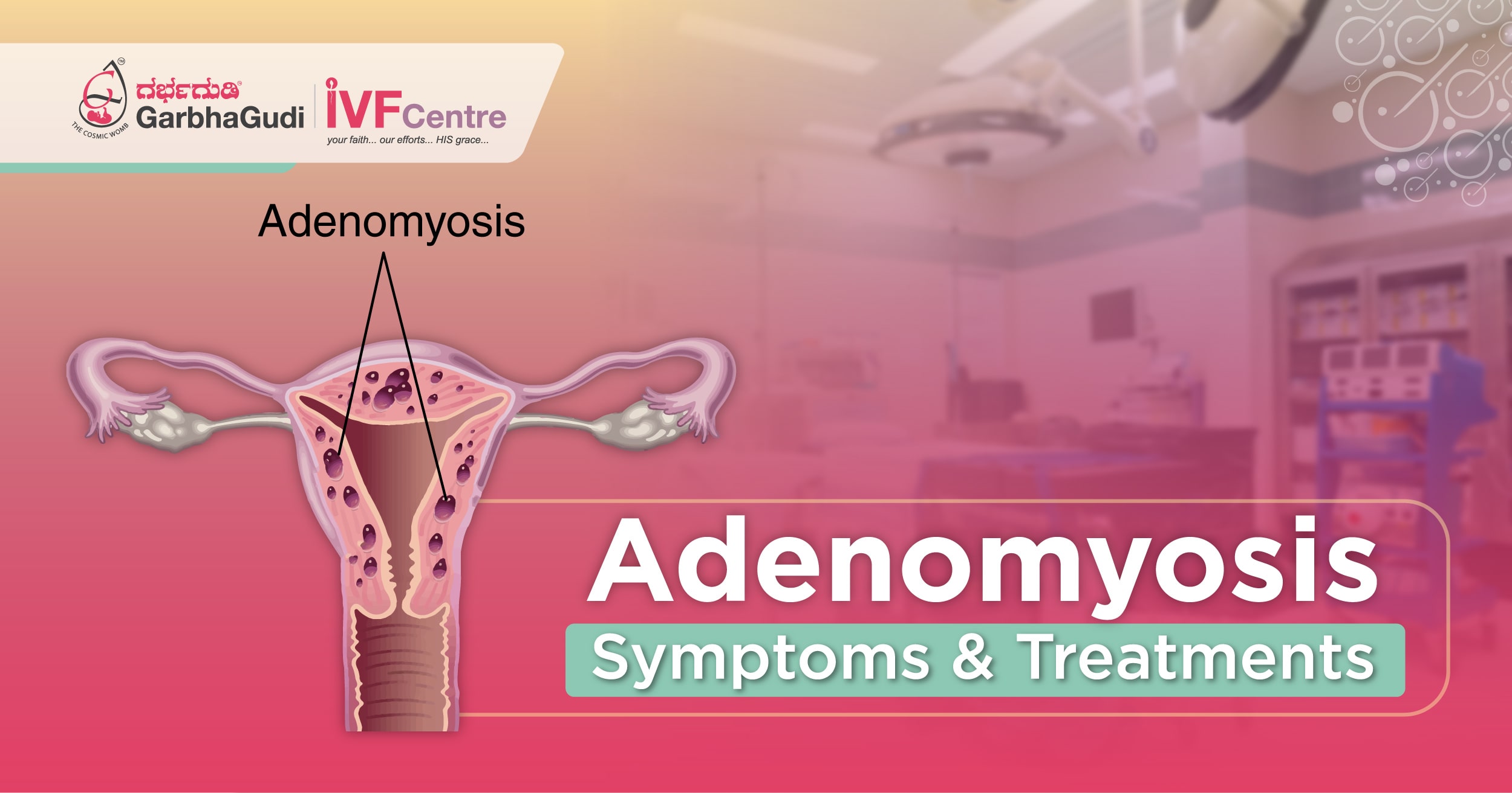 Adenomyosis Symptoms & Treatments 