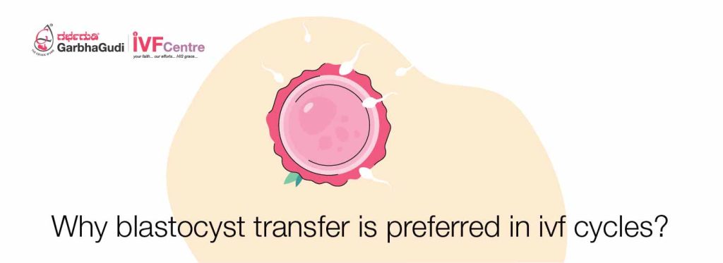 Why Blastocyst Transfer is Preferred in IVF Cycles