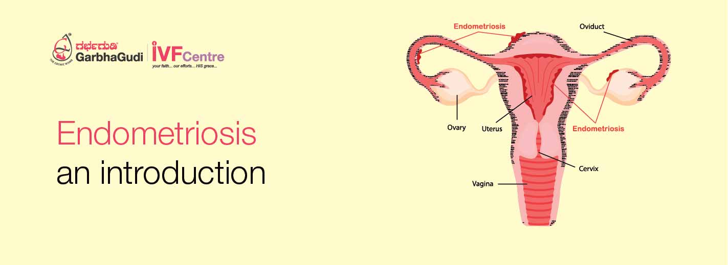 Endometriosis – an introduction